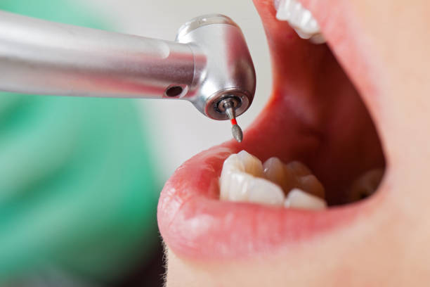 Best Root Canal Emergency Dentist  in Clinton, LA